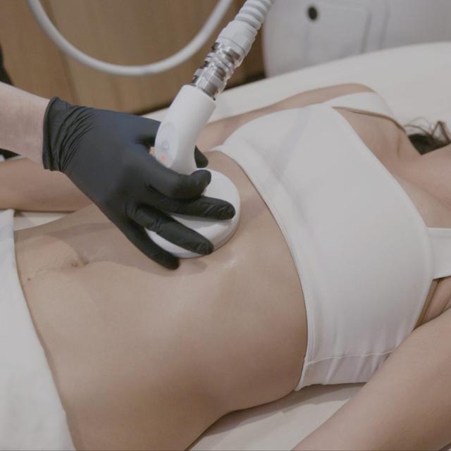 T-Shape2: Body Package- 6